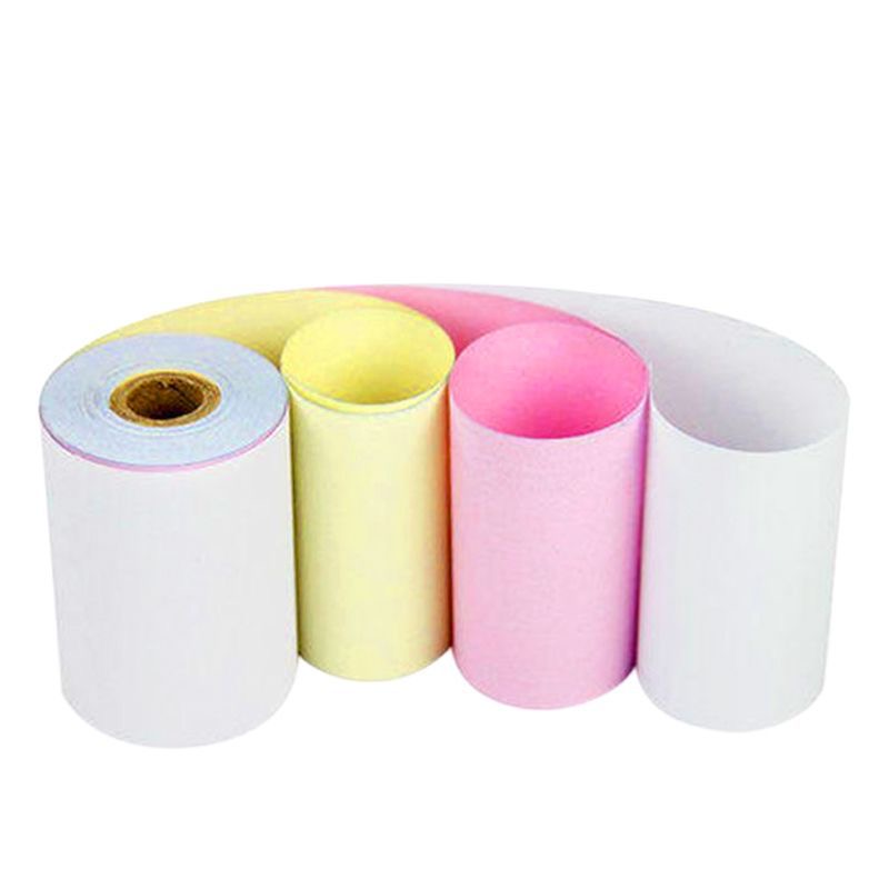 Qəbziniz zəifləyir? Sizi qeyd edən Karbonsuz Kağız Keyfiyyəti Xətası.